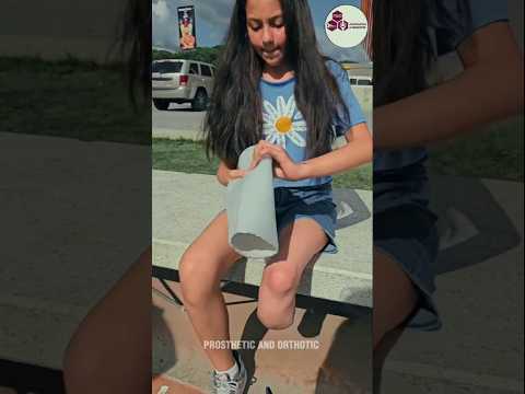 Unstoppable Spirit  🦵Little Girl with Prosthetic Leg Living Life to the Fullest #limbs #everygirl