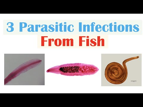 Schistosomiasis Bilharziasis Causes Symptoms and Treatment