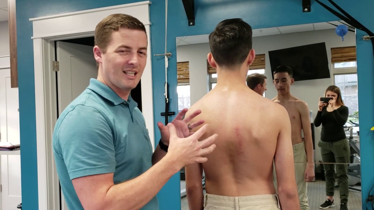 Schroth Method Exercises Explained!