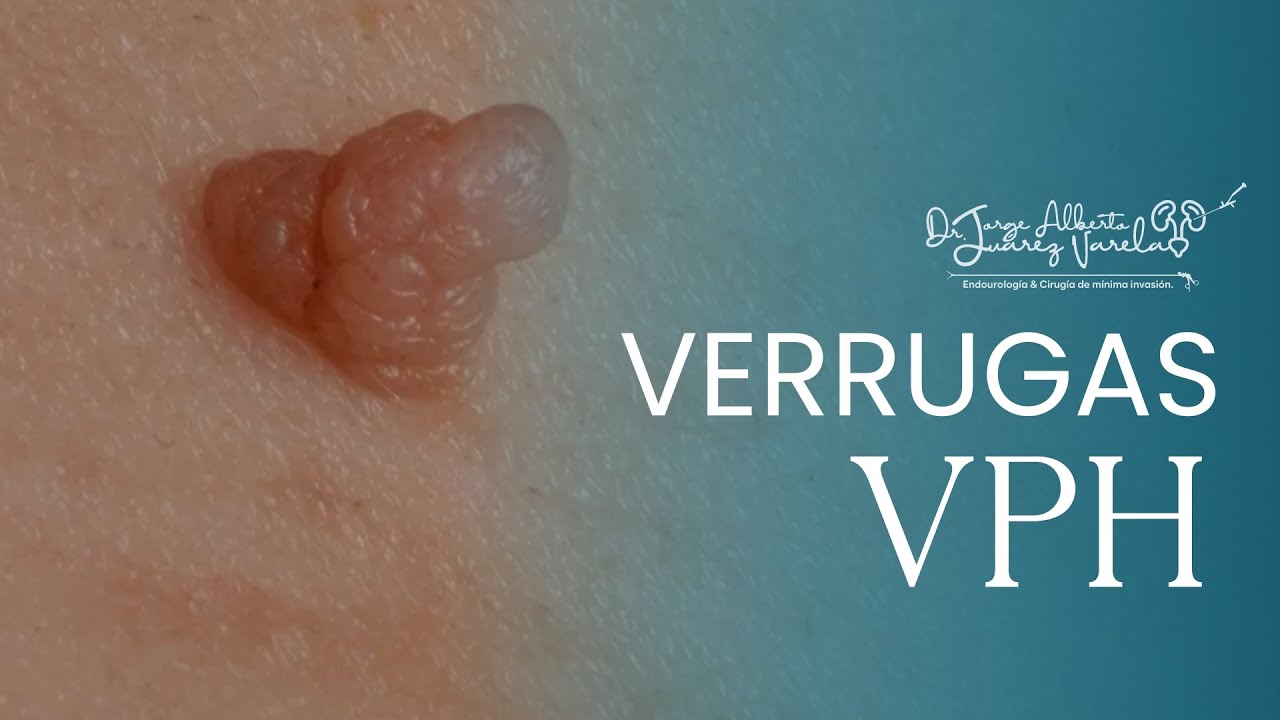 Jorge Alberto Juárez Varela-81