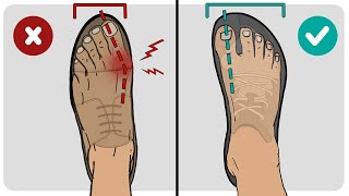 The Best Type of Shoes For Bunions