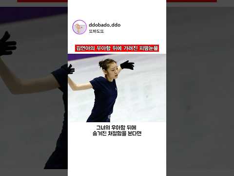 김연아의 우아함 뒤에 가려진 피땀눈물