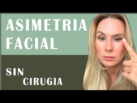 Facial asymmetry treatment without surgery. How to correct facial asymmetry