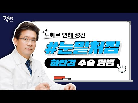 노화로 인해 불룩해진 눈밑 개선하는 하안검 성형 수술 방법은?