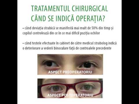 vârsta acuității vizuale ajuta bătăușii să priveze