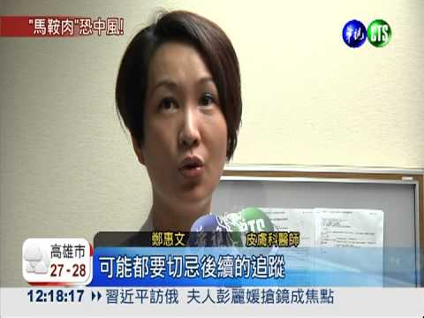 "馬鞍肉"太肥厚... 中風容易上身!