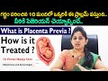 Types of Placenta Previa and how are they Treated ? Anu My Baby | Gynecologist | Eagle Media Works