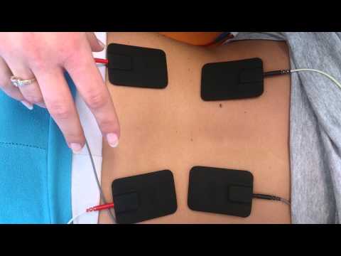 interferencja 4 polowa ulożenie elektrod