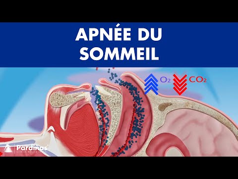 Apnée du sommeil ©
