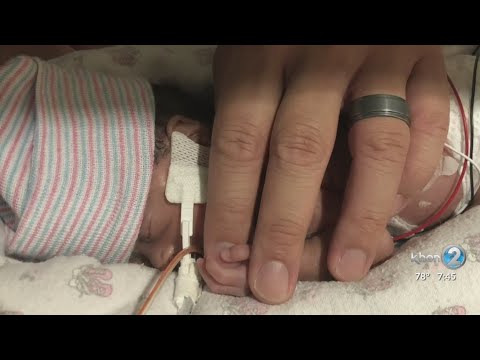 Hawaii baby born at 23 weeks is now thriving thanks to Kapiolani Medical Center