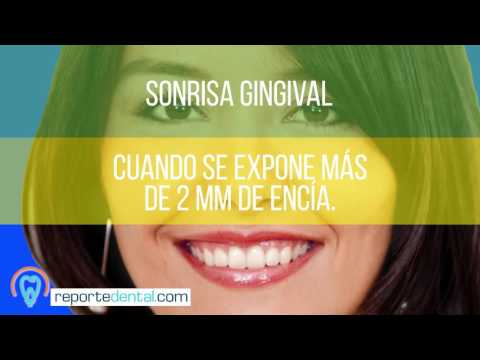 Tipos de Sonrisas | Tu Salud Guía