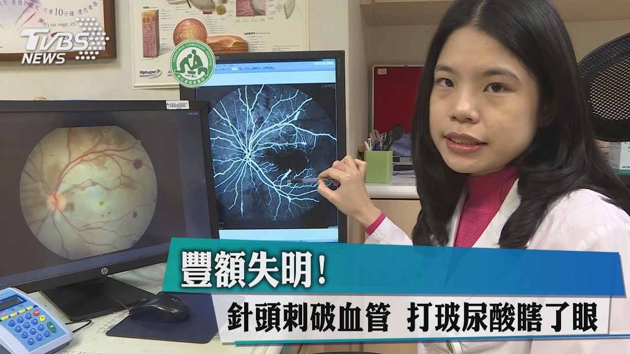 豐額失明!針頭刺破血管 打玻尿酸瞎了眼