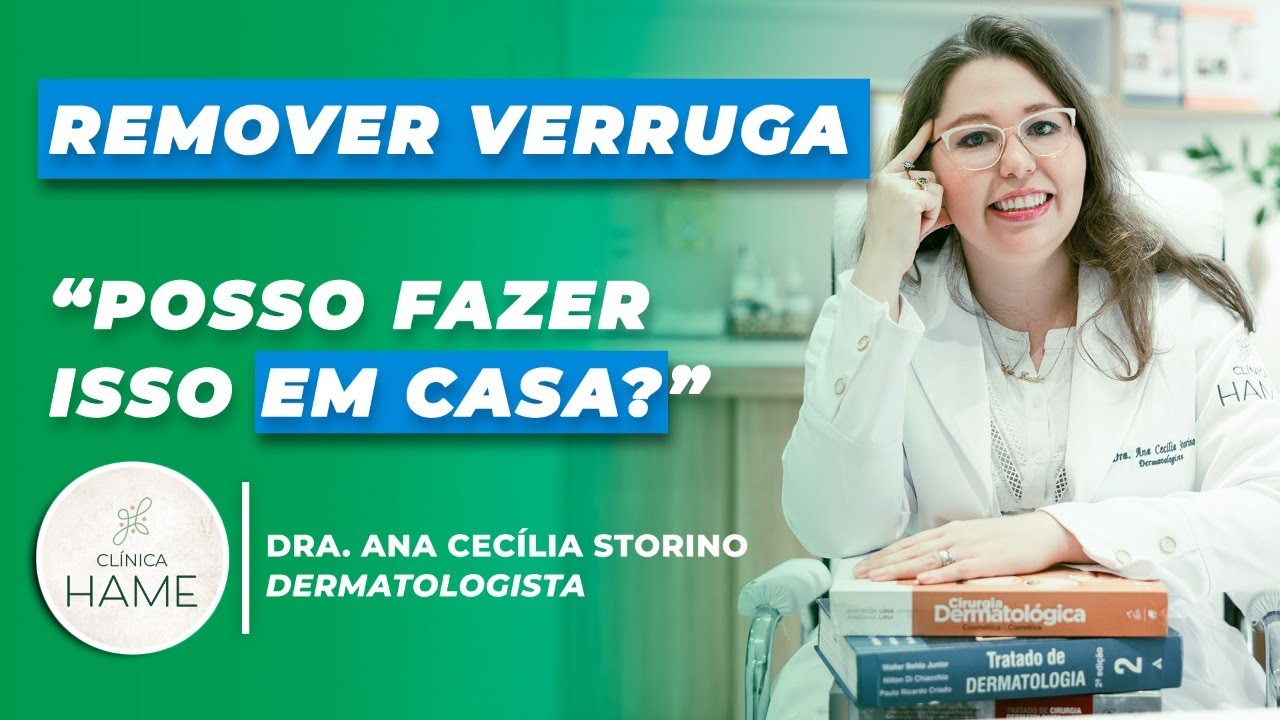 Como remover uma verruga? | Saiba porque elas surgem na pele e o que fazer!