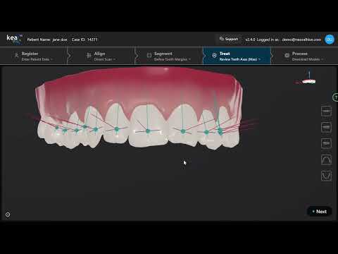 Review Teeth Axes (Maxilla)