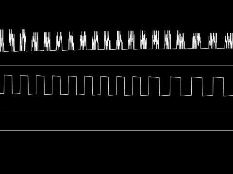 Eet Teyks Tu tu Shonka (AY-3-8910)