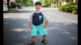 My Dwarfism Is One In A Million | BORN DIFFERENT