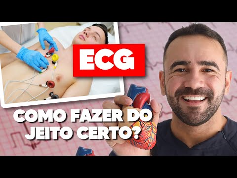 HOW TO DO AN ELECTROCARDIOGRAM (ECG)? WHERE TO PLACE THE ELECTRODES? Learn now!