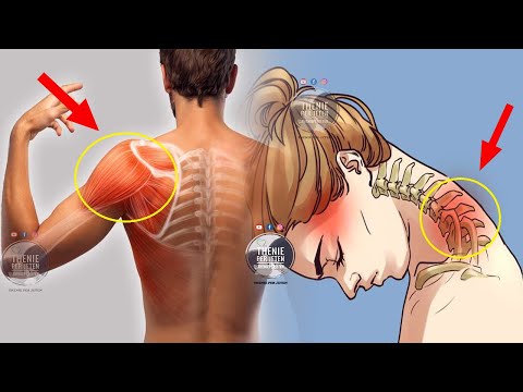 Ja si ti largoni dhimbjet e qafës dhe të shpatullave në kushte shtëpie me kete recete