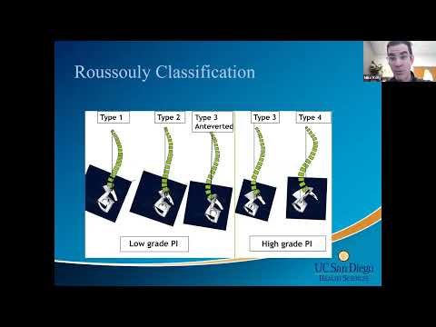 Sagittal Alignment in Spine Surgery presented by Michael Kelly, MD on April 25, 2022