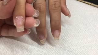 Cuticle removal with Atwood Industries cuticle bit