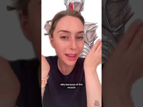 Trap Tox: Botox for Neck & Shoulder Pain #shorts