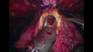 Catherine Mohr: Surgery's past, present and robotic future