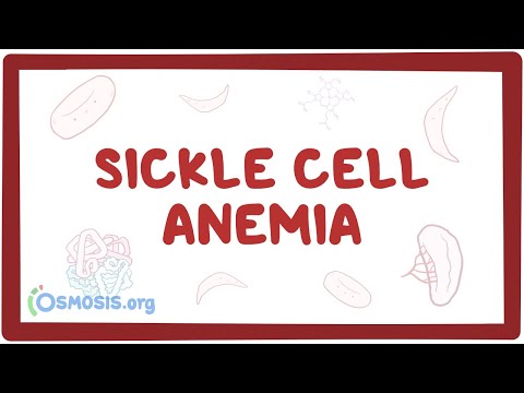 Sickle cell anemia - causes, symptoms, diagnosis, treatment & pathology