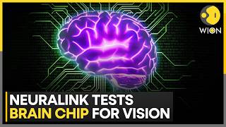 Neuralink Launches First European Brain Chip Trial in UK with Seven Paralyzed Patients