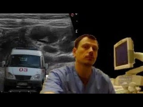 Pediatric Abdominal ultrasound - Intestinal intussusception and signs names