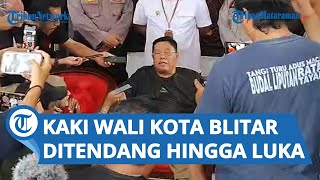 Wali Kota Blitar Jadi Korban Penganiayaan Perampok, Kakinya Ditendang hingga Terluka