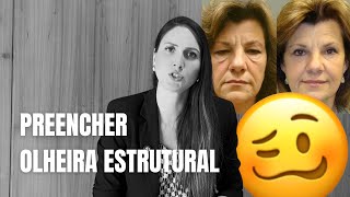 Preenchimento olheira estrutural. Será que todo mundo tem indicação?