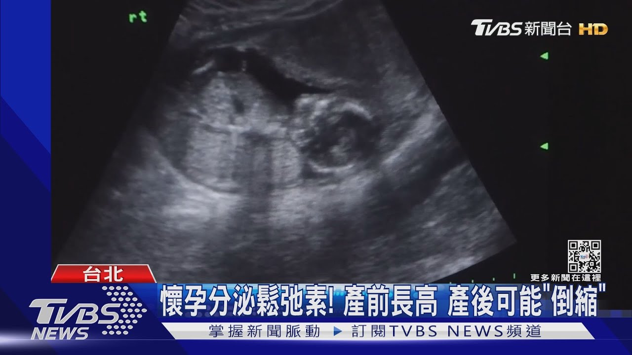懷孕長高6公分 產婦驚「要比老公高了啦」