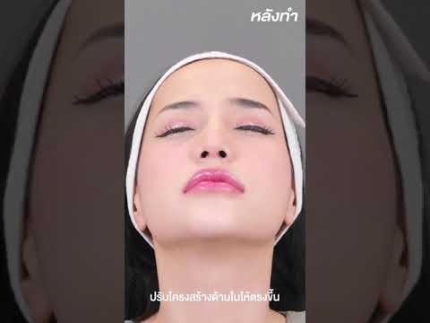 แก้จมูกเอียง และ สั้น