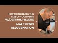 How To Increase The Size Of Your Penis W Dermal Fillers MALE PENIS REJUVENATION Dr Jason Emer