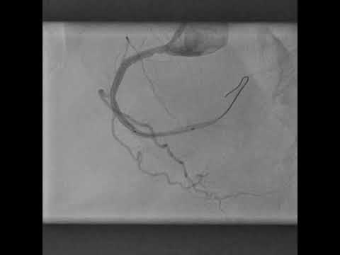 Rescue PCI to RCA - looks simple but complicated