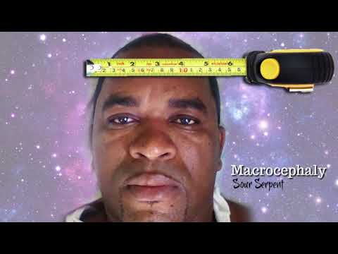 Sour Serpent - Macrocephaly (2018 Calypso)