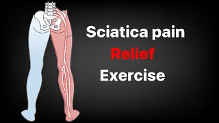 Best exercise for sciatica | sciatica pain relief exercises | sciatica permanent pain over |