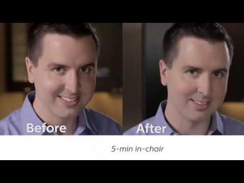 Philips ZOOM! QuickPro Whitening Varnish Demo