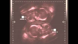 Odd Couple - Salute The King (Feat. Smoke DZA, Mikkey Halsted & Donny Goines)