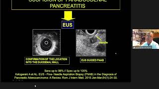 Download Lagu 'Mimics of Pancreatic Cancer' delivered by Dr. Gianni Morana Delivered at ICIS 2021 Thumbnail
