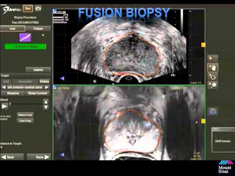 Moxifloxacin prostatitis dosage