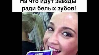 На что идут звезды, ради красивых зубов