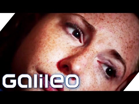 Medical miracle: Blind woman can see again overnight | Galileo Lunch Break