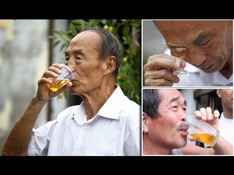 เป็นโรคสะเก็ดเงินที่ตรวจพบ น้ำผึ้งโรคสะเก็ดเงิน