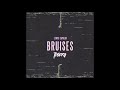 Lewis Capaldi - Bruises (Tesero Bootleg) Lewis Capaldi - Bruises (Tesero Bootleg)