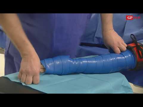 Kulisy zdrowia chirurgia ręki w Szpitalu SALUS