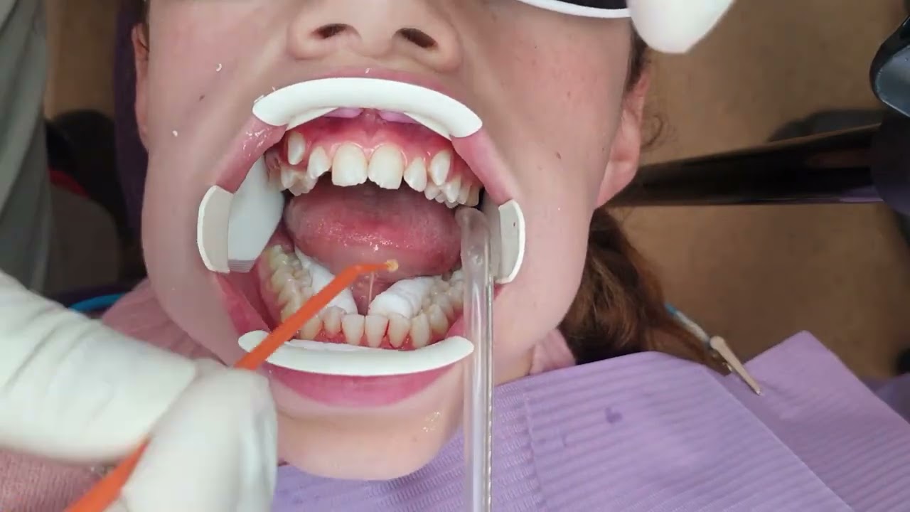 Bandup time lapse 3 slow