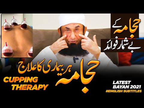 Maulana Tariq Jameel on Hijama