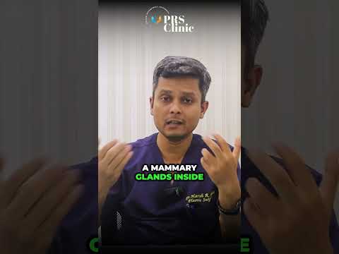Gynecomastia and Exercises