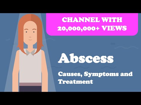 Abscess - Causes, Symptoms and Treatment